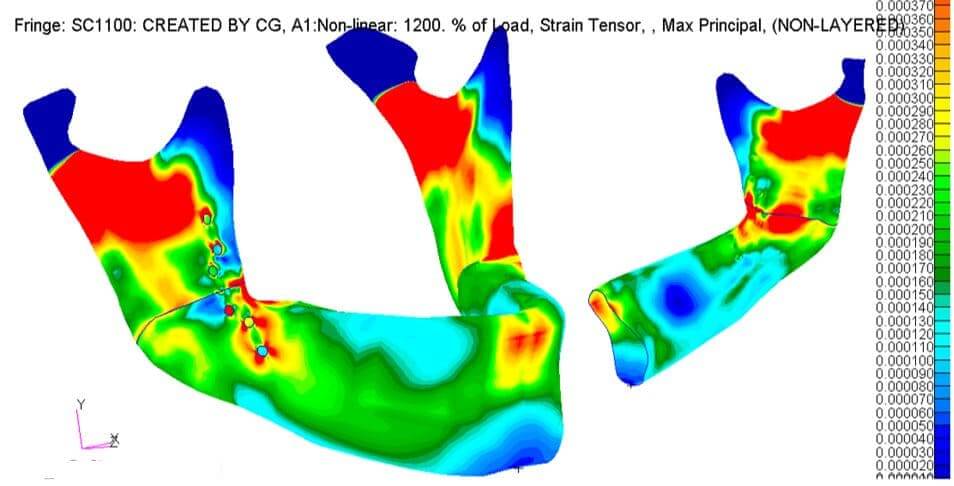 Graph Post Proc Bot LHS